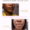 Transform your lips with this natural treatment.