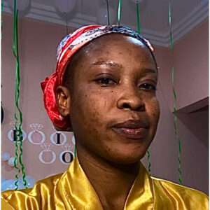 A woman with freckles on her face.